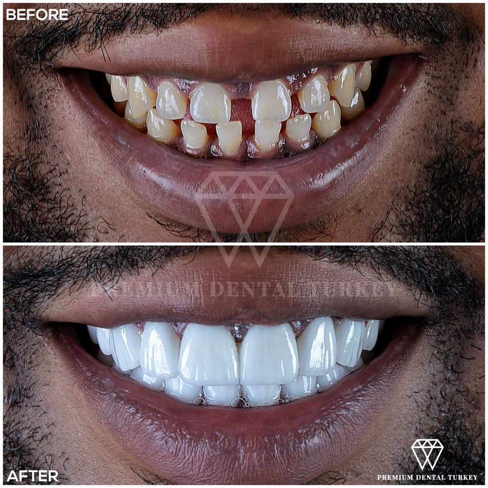 PREMIUM DENTAL TURKEY Updated May 2024 11 Photos 8 Duncannon