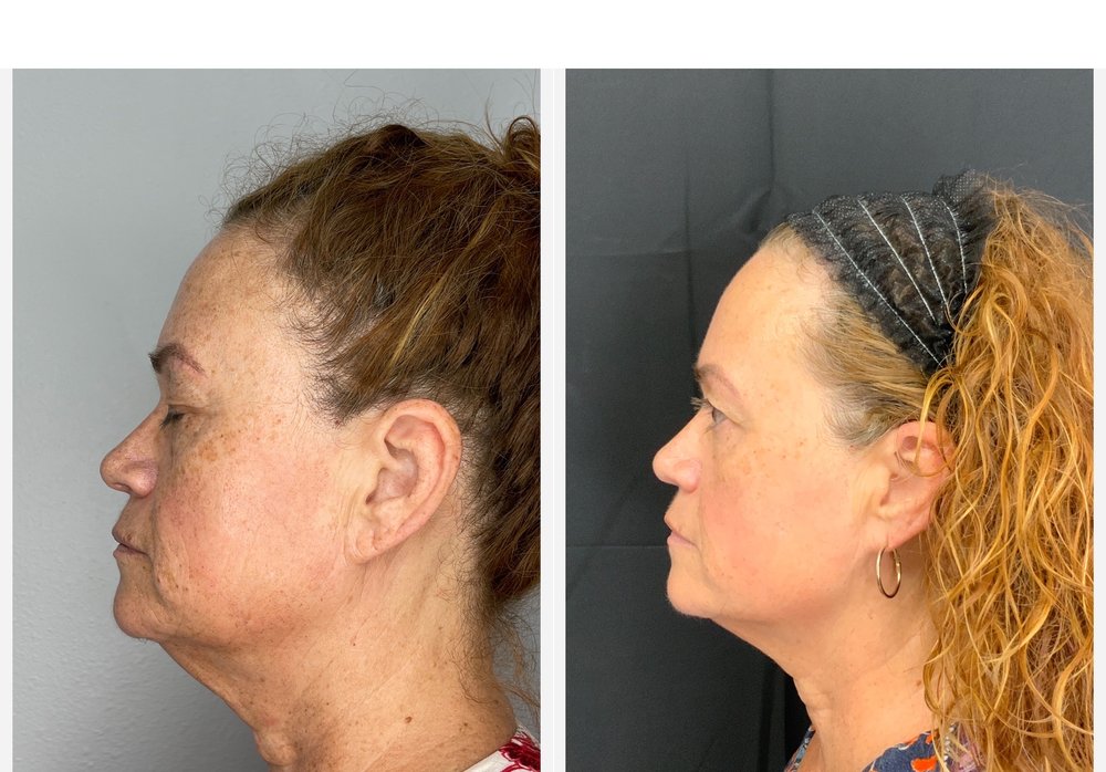 A FRESH FACE AESTHETICS Updated October 2024 11 Photos & 62 Reviews