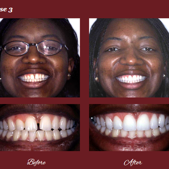 Ralph S Reilly, DMD - Advanced Dentistry - Cosmetic Dentists Near Me - Middlesex, New Jersey Ralph S Reilly, DMD - Advanced Dentistry - Cosmetic Dentists Near Me - Middlesex, New Jersey