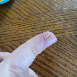Ava Nails & Spa - Finger a week later