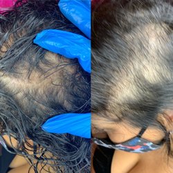 Browed n Bodied - Scalp Pigmentation for Hair Loss