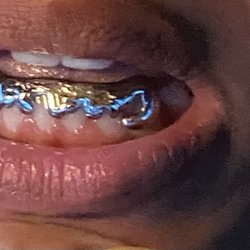 Gold Mart - Fronts/grill