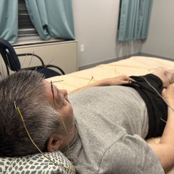 Zhao acupuncture 赵氏针灸