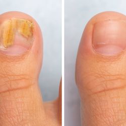 Elite Laser Nail Clinic & Salon
