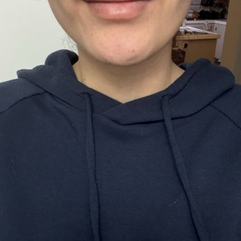 NakedMD - Regular smile - Medical Spas Near Me - Chino Hills, California NakedMD - Regular smile - Medical Spas Near Me - Chino Hills, California