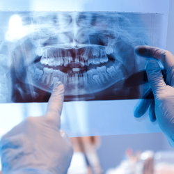 Complete Dentistry