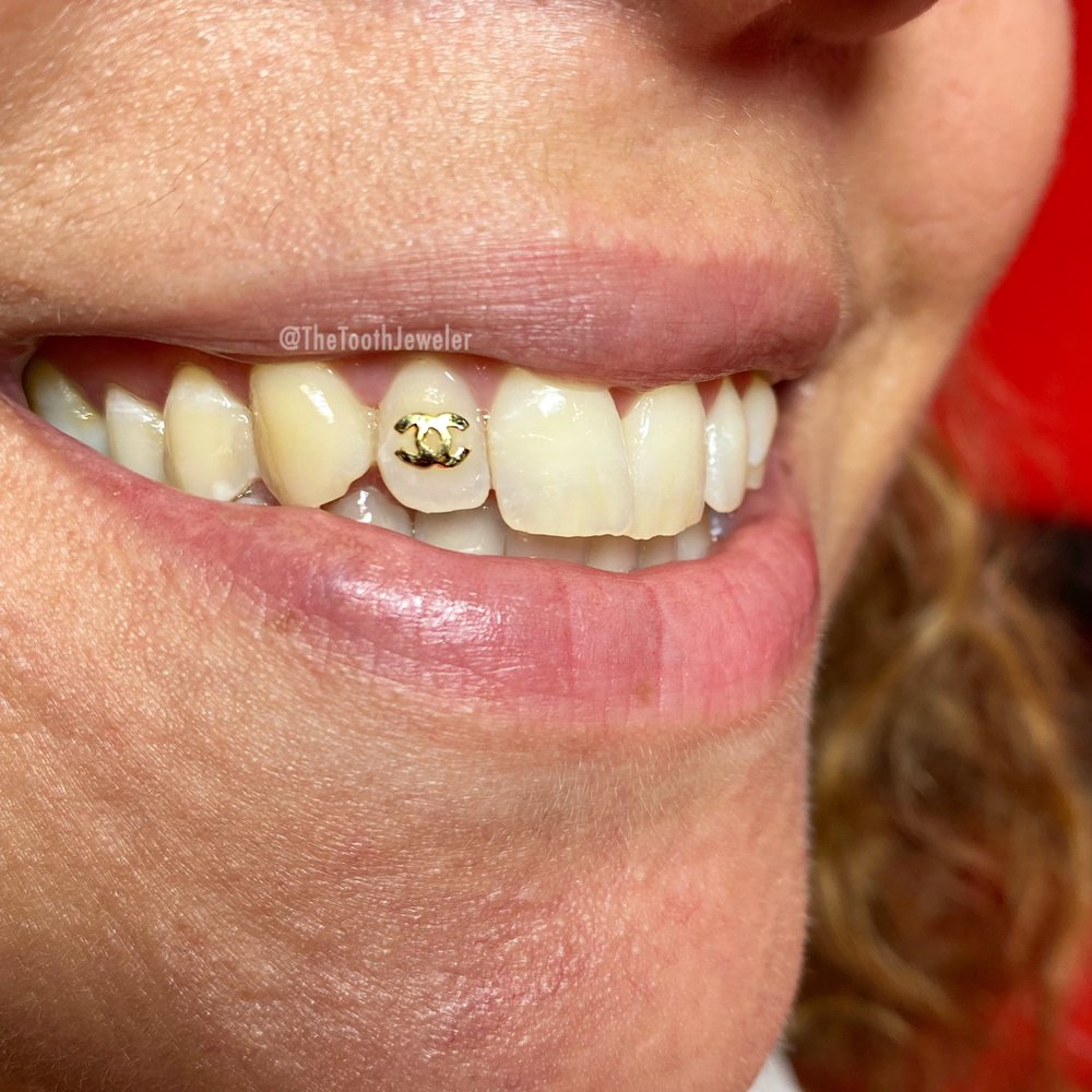 THE TOOTH JEWELER Updated July 2024 37 Photos 3688 Clearview Ave