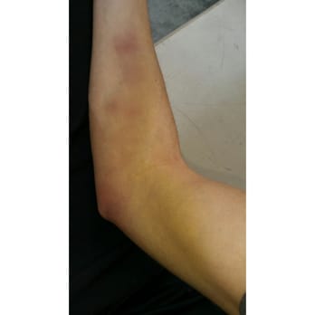 Quest Diagnostics - You shouldn't be allowed to take blood! - Laboratory Testing Near Me - Henderson, Nevada
