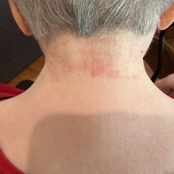 Supercuts - Rash from clippers and a small cut - Hair Salons Near Me - BURBANK, California
