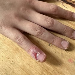 Henry Ford Wyandotte Hospital - My son's finger wound.