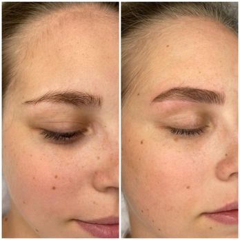 Viktoria La Beaute - Microneedling is a safe and effective treatment - Eyebrow Services Near Me - Los Angeles, California Viktoria La Beaute - Microneedling is a safe and effective treatment - Eyebrow Services Near Me - Los Angeles, California