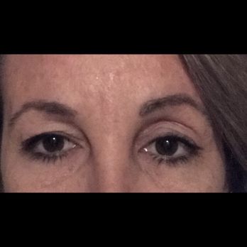 Nalan Narine, MD - A New You Aesthetics - Anesthesiologists Near Me - Temecula, California Nalan Narine, MD - A New You Aesthetics - Anesthesiologists Near Me - Temecula, California
