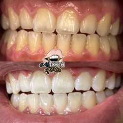 M’s Tooth Gems - One hour session