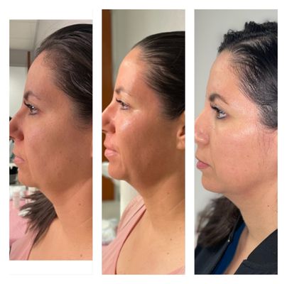 QUEEN CREEK WELLNESS & AESTHETICS - Updated August 2026 - 16 Photos - 20713 E Ocotillo Rd, Queen Creek, Arizona - Medical Spas - Phone Number