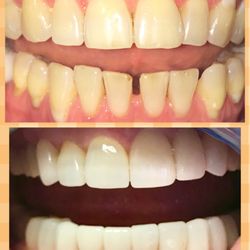 Downers Dental - Complete makeover