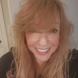 Same Day Smile Designs - My new natural looking smile. I've been told it's stunning.