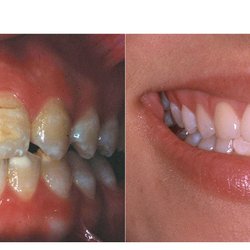 Alberto J Ambard, DDS MS