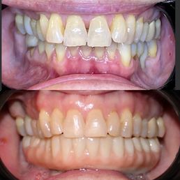 before and after before and after