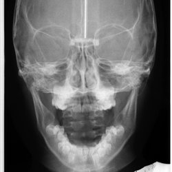 Dental Center Imaging - Open PA cephalometric