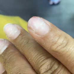 The Luxe Nails & Spa - This wasn't like this before. Now we're missing some nail from the bed and it was bleeding.