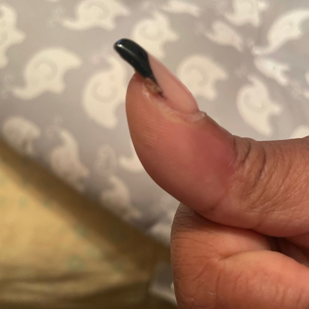 Fancy Nails - Swollen finger - Nail Salons Near Me - West Haverstraw, New York Fancy Nails - Swollen finger - Nail Salons Near Me - West Haverstraw, New York