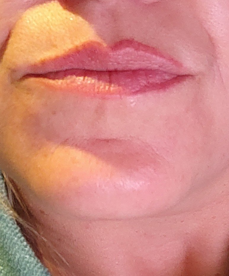 Beyond Esthetix Logo