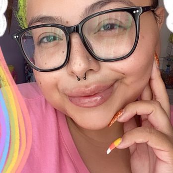 The Image Center - super swollen still but i love them! - Plastic Surgeons Near Me - Irvine, California The Image Center - super swollen still but i love them! - Plastic Surgeons Near Me - Irvine, California