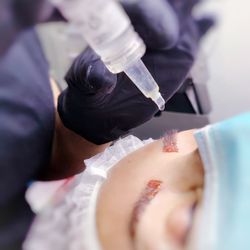 Visage New York - Tattoo Removal