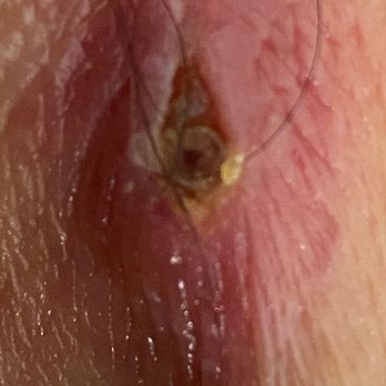Elliott Call, MD - Dermatologists Near Me - Livermore, California Elliott Call, MD - Dermatologists Near Me - Livermore, California