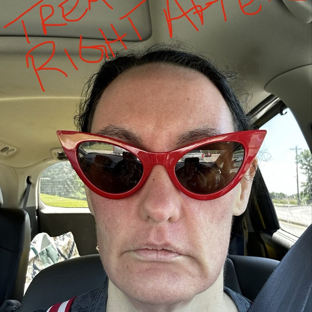Turkle & Associates - Right after 2nd treatment in the car - Cosmetic Surgeons Near Me - Carmel, Indiana