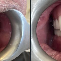 Soothing Dental - A Life-Changing Dental Transformation
From damaged and failing teeth to a healthy, natural-looking smile. A full smile restoration.