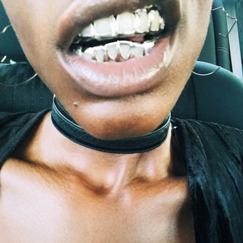 Gold Teeth Gallery - Jewelry Near Me - Oakland, California Gold Teeth Gallery - Jewelry Near Me - Oakland, California