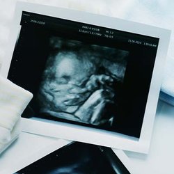 Beautiful Beginnings Ultrasound