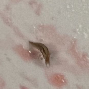 DoubleTree by Hilton Hotel Chicago - Oak Brook - Bug found in the hotel breakfast - Hotels Near Me - Oak Brook, Illinois
