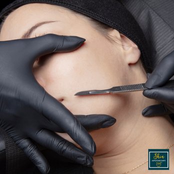 Skin Apothecary - Dermaplaning - Skin Care Near Me - Cave Creek, Arizona Skin Apothecary - Dermaplaning - Skin Care Near Me - Cave Creek, Arizona