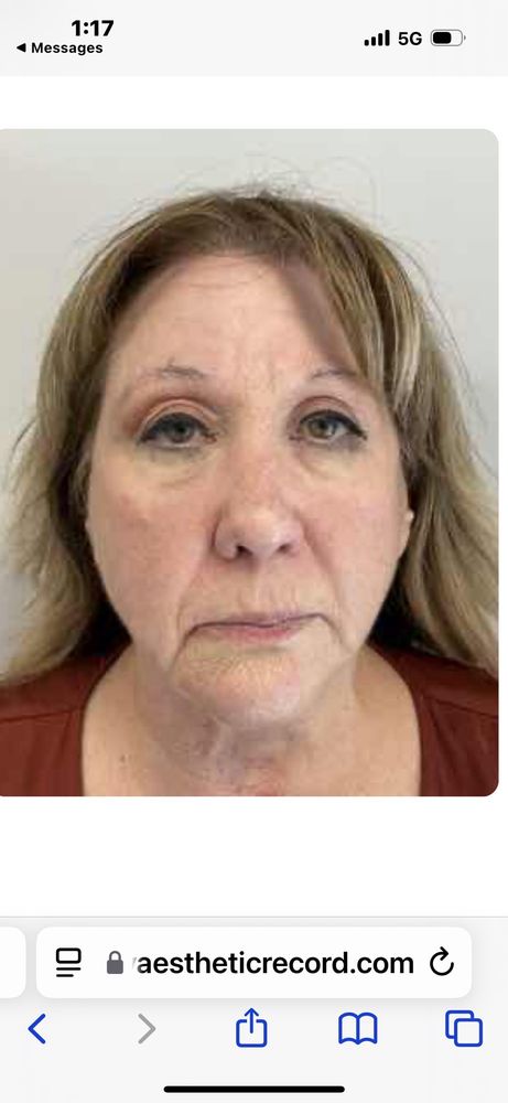 Bloom Medical Aesthetics Logo