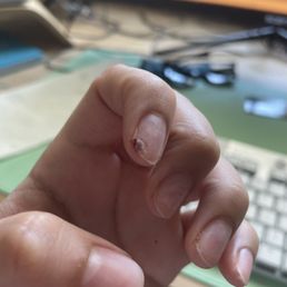 Most horrific acrylic removal I've ever experienced Most horrific acrylic removal I've ever experienced