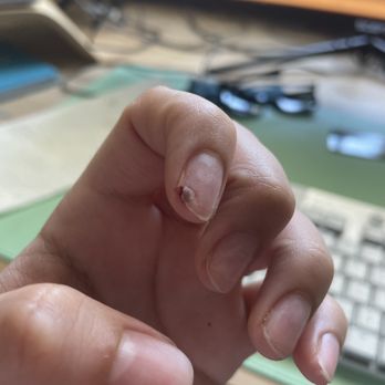 Olivera Nail Spa - Most horrific acrylic removal I've ever experienced - Nail Salons Near Me - Concord, California Olivera Nail Spa - Most horrific acrylic removal I've ever experienced - Nail Salons Near Me - Concord, California