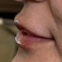 Lake Stevens Family & Cosmetic Dentistry