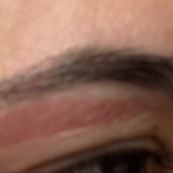 Diamond Nail Bar - Burn from waxing at Diamond Nail. - Nail Salons Near Me - San Jose, California