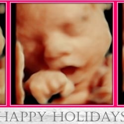 BB Precious Ultrasound - Get your Special Holiday Gift for Mothers-to-Be...  A Bonding Experience That Melts The Heart  2D, 3D and the NEW HD Live Ultrasound