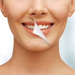 AZ Teeth Whitening Spa - Cosmetic teeth whitening with Hydrogen Peroxide Gel & Blue Light Technology produces stunning results!