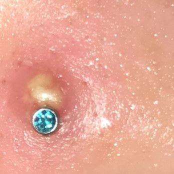 Revelation Studio's - This is the outcome of my wife getting her nose pierced by these hacks. We had to go to a professional to find out it was pierced wrong. - Tattoo Near Me - Derry, New Hampshire
