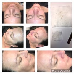 Divine Beauty and Style - Dermaplaning Facial