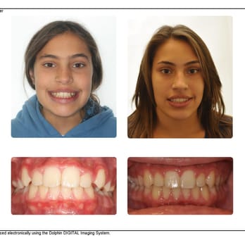 MacGinnis Orthodontics - Orthodontists Near Me - Fullerton, California MacGinnis Orthodontics - Orthodontists Near Me - Fullerton, California