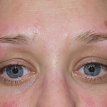 Ulta Beauty - Post swelling. The techs negligence resulted in physical injury. - Hair Salons Near Me - Chandler, Arizona Ulta Beauty - Post swelling. The techs negligence resulted in physical injury. - Hair Salons Near Me - Chandler, Arizona