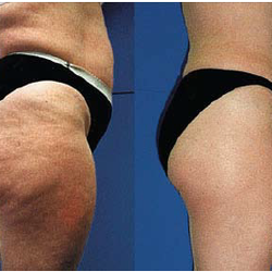 Elite Therapeutics Body and Skin Care