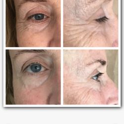 Skin & Tonic - Before & After's
