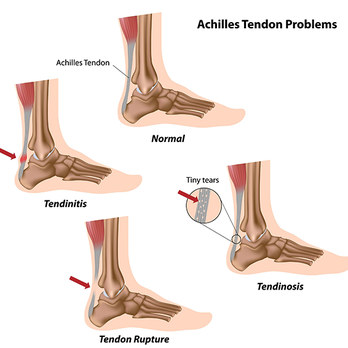 River Podiatry - Podiatrists Near Me - Pearl River, New York River Podiatry - Podiatrists Near Me - Pearl River, New York