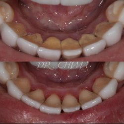 Bixby Hill Dental